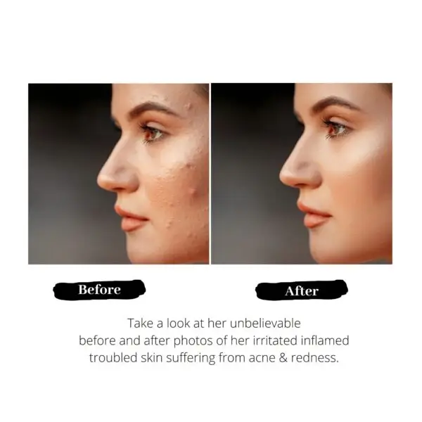 Tina Mattern Pore Tightening Serum – Controls Sebum & Minimizes Pores - Image 4