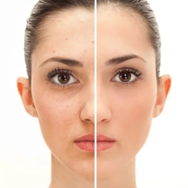 Tina Mattern Tinted Moisturizer with Hyaluronic Acid & SPF 30 - Image 2