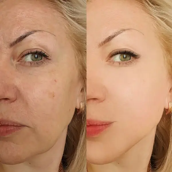 Tina Mattern Tinted Moisturizer with Hyaluronic Acid & SPF 30 - Image 4